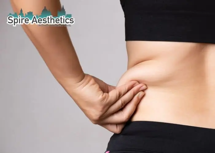 Image of woman pinching fat on their hips Streatley. Fat Freezing treatment