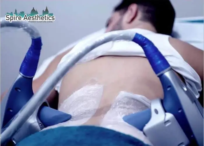 Man having fat freezing treatment done on love handles before a competitions Streatley to create a sculpted look.