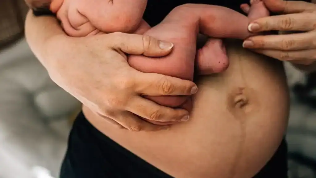 Why Is My Stomach Still Big After Pregnancy Streatley?